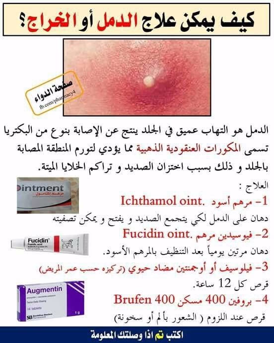 معلومة